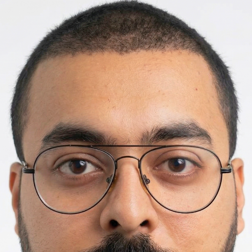 After Hair Transplant
